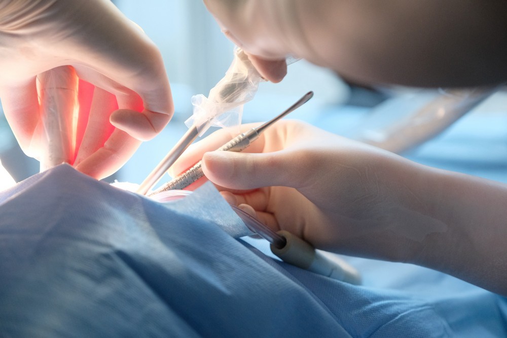 chirurgie dentara targoviste, extractie dentara targoviste, extractie mase minte targoviste pret